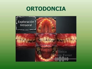 ORTODONCIA
 