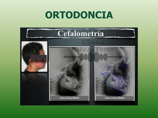 ORTODONCIA
 