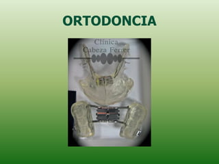 ORTODONCIA
 