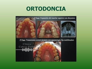 ORTODONCIA
 