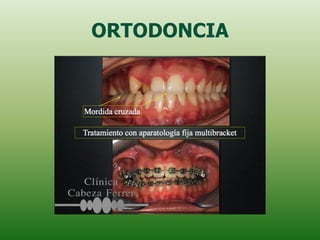 ORTODONCIA
 