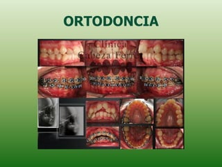 ORTODONCIA
 