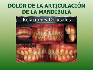 DOLOR DE LA ARTICULACIÓN
    DE LA MANDÍBULA
 
