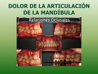 DOLOR DE LA ARTICULACIÓN
    DE LA MANDÍBULA
 