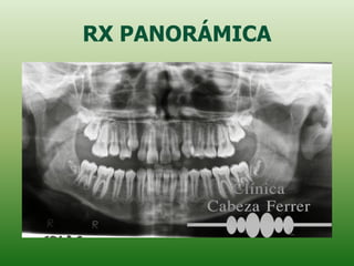 RX PANORÁMICA
 
