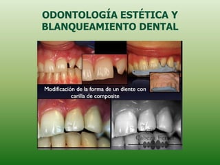 ODONTOLOGÍA ESTÉTICA Y
BLANQUEAMIENTO DENTAL
 