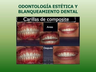 ODONTOLOGÍA ESTÉTICA Y
BLANQUEAMIENTO DENTAL
 