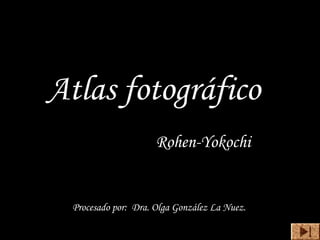Atlas fotográfico
Rohen-Yokochi
Procesado por: Dra. Olga González La Nuez.
 