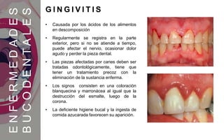 ENFERMEDADES
BUCODENTALES
G I N G I V I T I S
Causada por los
ácidos de los
alimentos en
descomposición
• Causada por los ácidos de los alimentos
en descomposición
• Regularmente se registra en la parte
exterior, pero si no se atiende a tiempo,
puede afectar el nervio, ocasionar dolor
agudo y perder la pieza dental.
• Las piezas afectadas por caries deben ser
tratadas odontológicamente, tiene que
tener un tratamiento precoz con la
eliminación de la sustancia enferma.
• Los signos consisten en una coloración
blanquecina y marronácea al igual que la
destrucción del esmalte, luego de la
corona.
• La deficiente higiene bucal y la ingesta de
comida azucarada favorecen su aparición.
 