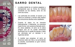 • La placa dental es un residuo pegajoso y
transparente que se forma de manera
constante en los dientes, tanto de día
como de noche.
• Las partículas de comida, el azúcar y la
saliva se combinan y forman este residuo
que ensucia los dientes entre cepillados.
• Cuando la placa no se remueve
habitualmente y totalmente, se endurece
hasta formar una sustancia llamada sarro.
En otras palabras, el sarro es la placa
antigua que ya no puede removerse
fácilmente con tu cepillo de dientes y debe
ser eliminada por un dentista o un
higienista dental.
• A medida que progresa, el sarro se
endurece cada vez más y va aumentando
su tamaño, acumulando un gran número
de bacterias.
ENFERMEDADES
BUCODENTALES
S A R R O D E N TA L
 