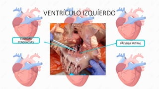 VENTRÍCULO IZQUÍERDO
VÁLVULA MITRAL
CUERDAS
TENDINOSAS
 