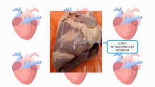 SURCO
INTERVENTRICULAR
POSTERIOR
 