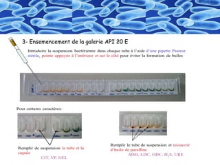 3- Ensemencement de la galerie API 20 E
 
