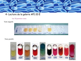 4- Lecture de la galerie API 20 E
 