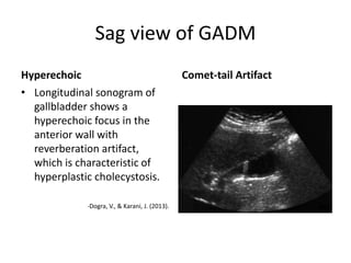 Gallbladder | PPTX