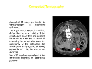 Abdominal CT scans are inferior to
ultrasonography in diagnosing
gallstones.
The major application of CT scans is to
define the course and status of the
extrahepatic biliary tree and adjacent
structures. It is the test of choice in
evaluating the patient with suspected
malignancy of the gallbladder, the
extrahepatic biliary system, or nearby
organs, in particular, the head of the
pancreas.
Use of CT scan is an integral part of the
differential diagnosis of obstructive
jaundice.
Computed Tomography
 