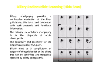 Biliary scintigraphy provides a
noninvasive evaluation of the liver,
gallbladder, bile ducts, and duodenum
with both anatomic and functional
information.
The primary use of biliary scintigraphy
is in the diagnosis of acute
cholecystitis.
The sensitivity and specificity for the
diagnosis are about 95% each.
Biliary leaks as a complication of
surgery of the gallbladder or the biliary
tree can be confirmed and frequently
localized by biliary scintigraphy.
Biliary Radionuclide Scanning (Hida Scan)
 