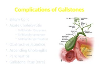 • Biliary Colic
• Acute Cholecystitis
• Gallbladder Empyema
• Gallbladder gangrene
• Gallbladder perforation
• Obstructive Jaundice
• Ascending Cholangitis
• Pancreatitis
• Gallstone Ileus (rare)
Complications of Gallstones
 