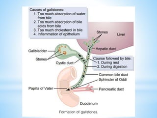GALLBLADDER AND BILE (2).pptx
