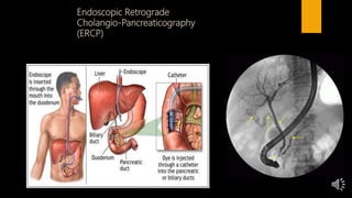 Gall bladder & bile ducts with narration | PPTX