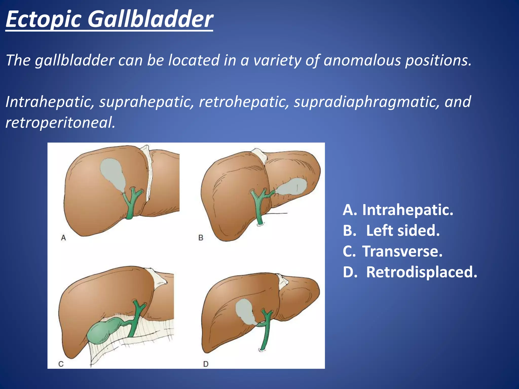 Gall bladder & biliary tract anomalies and variants | PPTX