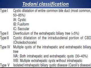 Todani classification
 