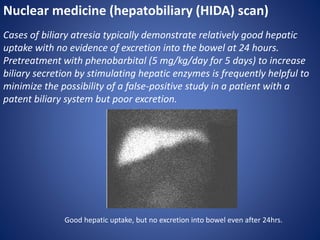Nuclear medicine (hepatobiliary (HIDA) scan)
Cases of biliary atresia typically demonstrate relatively good hepatic
uptake with no evidence of excretion into the bowel at 24 hours.
Pretreatment with phenobarbital (5 mg/kg/day for 5 days) to increase
biliary secretion by stimulating hepatic enzymes is frequently helpful to
minimize the possibility of a false-positive study in a patient with a
patent biliary system but poor excretion.
Good hepatic uptake, but no excretion into bowel even after 24hrs.
 