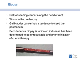 Biopsy
• Risk of seeding cancer along the needle tract
• Worse with core biopsy
• Gallbladder cancer has a tendency to seed the
peritoneum
• Percutaneous biopsy is indicated if disease has been
determined to be unresectable and prior to initiation
of chemotherapy
 