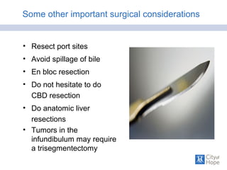 Some other important surgical considerations
• Resect port sites
• Avoid spillage of bile
• En bloc resection
• Do not hesitate to do
CBD resection
• Do anatomic liver
resections
• Tumors in the
infundibulum may require
a trisegmentectomy
 