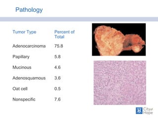 Pathology
Tumor Type Percent of
Total
Adenocarcinoma 75.8
Papillary 5.8
Mucinous 4.6
Adenosquamous 3.6
Oat cell 0.5
Nonspecific 7.6
 
