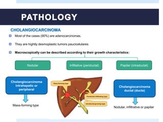  Most of the cases (90%) are adenocarcinomas.
 They are hightly desmoplastic tumors paucicelulares
 Macroscopically can be described according to their growth characteristics:
CHOLANGIOCARCINOMA
Nodular Infiltative (periductal) Papilar (intraductal)
Cholangiocarcinoma
intrahepatic or
peripheral
Cholangiocarcinoma
ductal (ducts)
Mass-forming type
Nodular, infiltrative or papilar
 