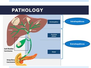 Extrahepáticos
Intrahepáticos
 