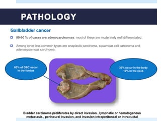  80-90 % of cases are adenocarcinomas: most of these are moderately well differentiated.
 Among other less common types are anaplastic carcinoma, squamous cell carcinoma and
adenosquamous carcinoma.
Gallbladder cancer
60% of GBC occur
in the fundus
30% occur in the body
10% in the neck
Bladder carcinoma proliferates by direct invasion , lymphatic or hematogenous
metastasis , perineural invasion, and invasion intraperitoneal or intraductal
 