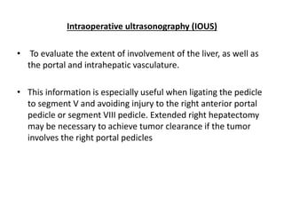 Intraoperative ultrasonography (IOUS) 
• To evaluate the extent of involvement of the liver, as well as 
the portal and intrahepatic vasculature. 
• This information is especially useful when ligating the pedicle 
to segment V and avoiding injury to the right anterior portal 
pedicle or segment VIII pedicle. Extended right hepatectomy 
may be necessary to achieve tumor clearance if the tumor 
involves the right portal pedicles 
 