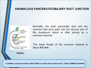 Gall bladder carcinoma.02