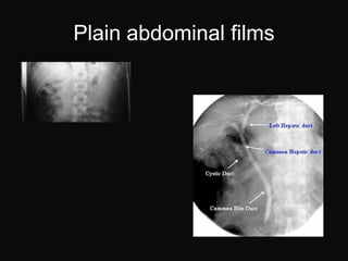 Plain abdominal films
 
