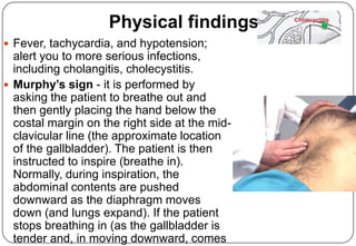 Gallbladder, The Big Picture | PPTX