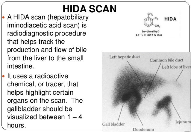 gallbladder the big picture pipida scan full form