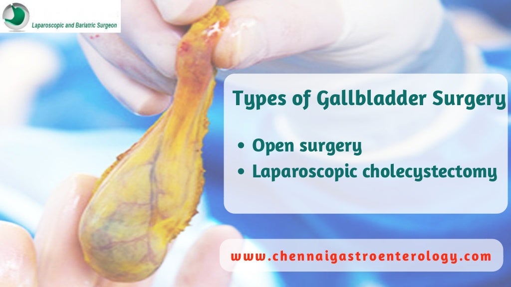Gallbladder Removal In Chennai Gallstone Removal Surgery