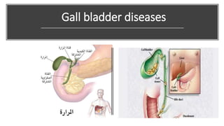 Gall bladder diseases
 