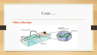 Cont….
• Biliary lithotripsy

 