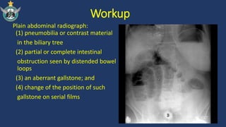 Management of patients with Gallstone Ileus | PPTX
