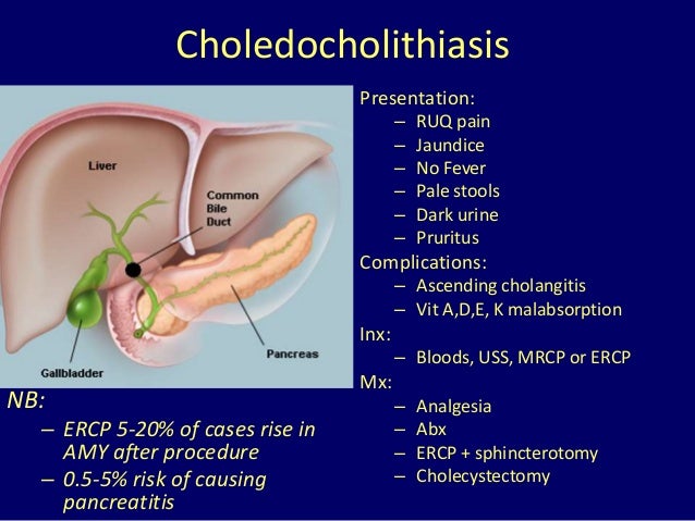 Choledocholithiasis Risk Choledocholithiasis After Cholecystectomy – WXCQRB