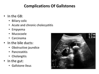 Complications Of Gallstones
• In the GB:
• Biliary colic
• Acute and chronic cholecystitis
• Empyema
• Mucocoele
• Carcinoma
• In the bile ducts:
• Obstructive jaundice
• Pancreatitis
• Cholangitis
• In the gut:
• Gallstone ileus
 