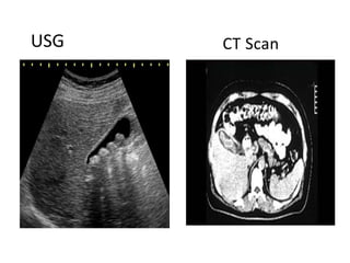 USG CT Scan
 