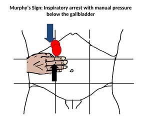 gallstones case presentation on anatomy physiloogy and pathophysiology ...