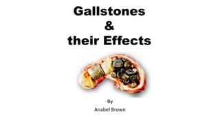 Gallstones
&
their Effects
By
Anabel Brown
 