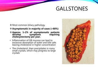 Gallstones and it s Complications PPT