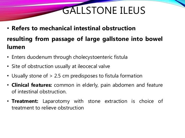 Gallstones And It S Complications