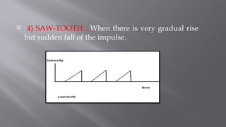  4) SAW-TOOTH : When there is very gradual rise
but sudden fall of the impulse.
 